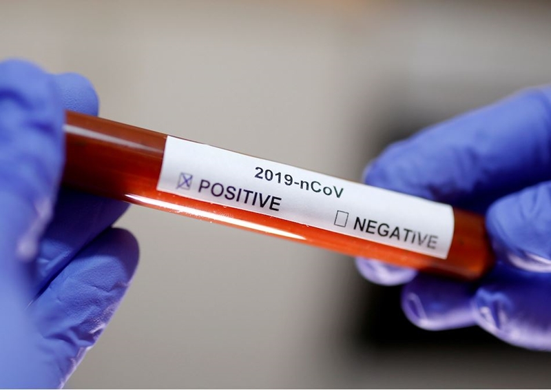 #BreakingNews: More FS schools face closure after #Covid19 outbreak | News Article