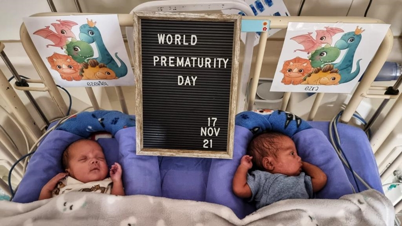 Parents of premature Bfn twins received amazing news | News Article