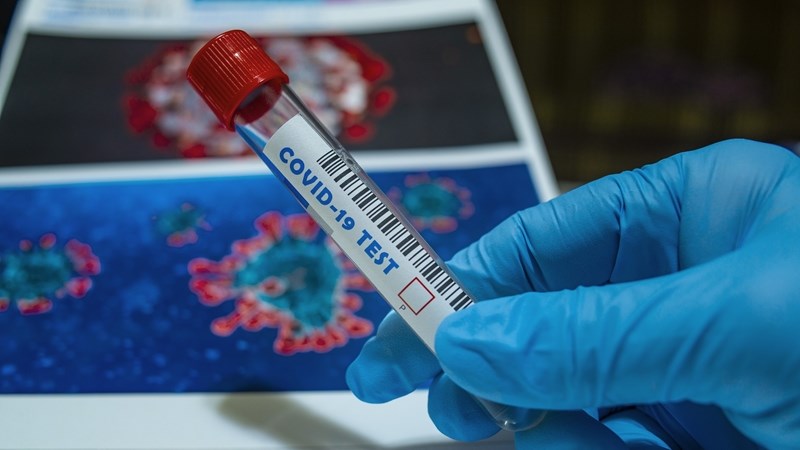 Declining new #Covid19 infections are encouraging: Dr Suliman Declining new #Covid19 infections are encouraging: Dr Suliman | News Article