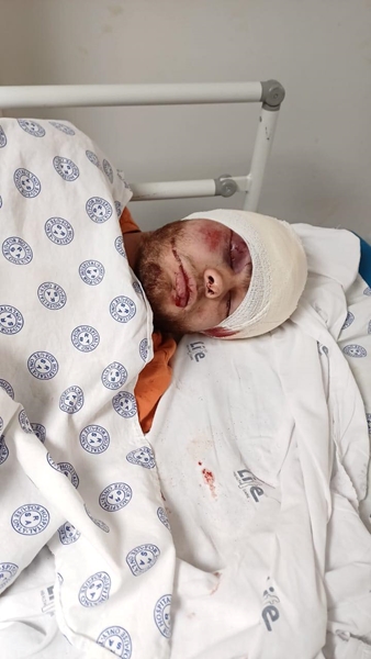 Klerksdorper kritiek ná aanval | News Article