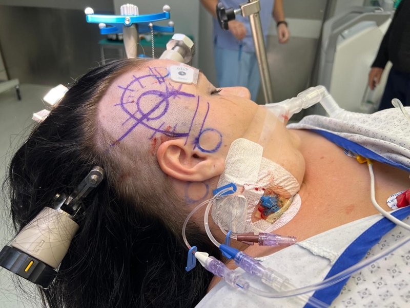 Klerksdorp-ma se breinoperasie nou ’n finansiële kopseer | News Article