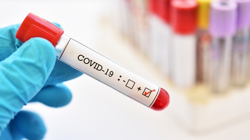 #CoronavirusSA: 2,028 new cases reported | News Article
