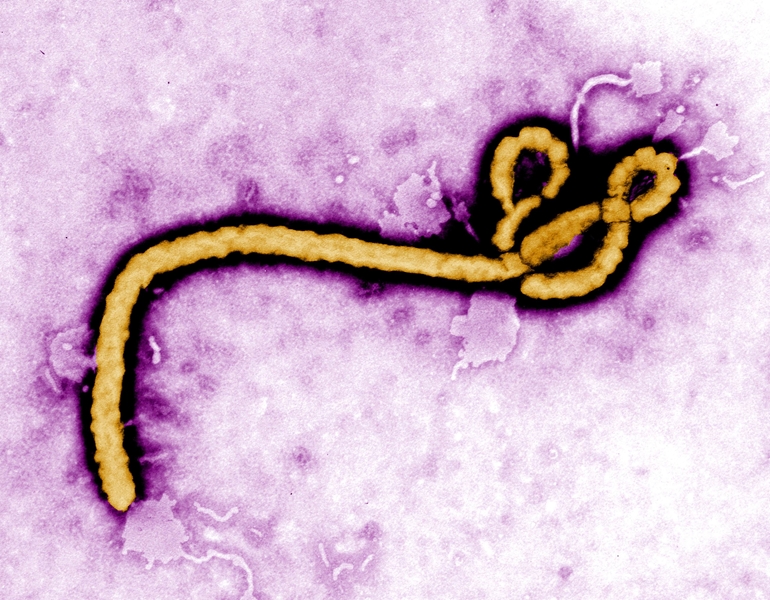 Ebola candidate vaccines heading to Uganda: WHO | News Article