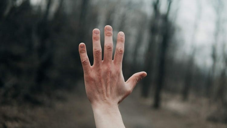 Weird Wide Web – Man voel deel van sy hand behoort nie aan hom nie Weird Wide Web – Man voel deel van sy hand behoort nie aan hom nie | News Article