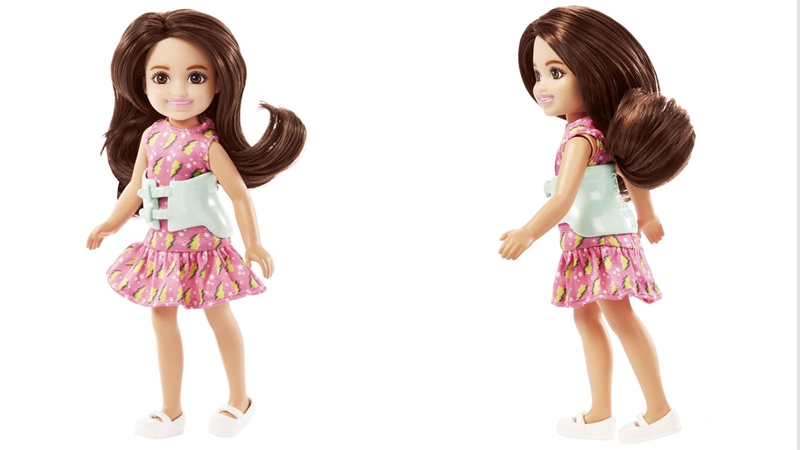 Mattel stel pop met skoliose bekend | News Article