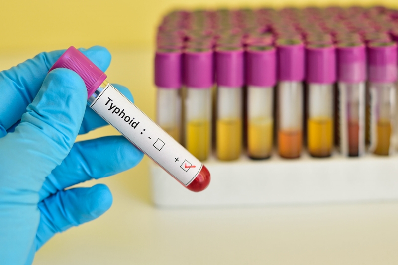'No confirmed typhoid' in JB Marks | News Article