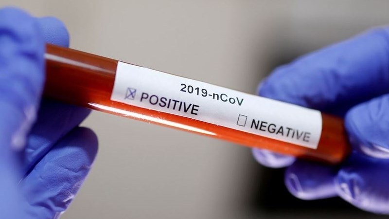 SA’s #Covid19 positivity rate shows a significant decrease | News Article