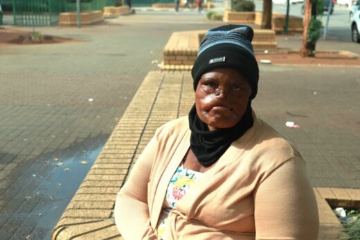Honde-aanval: Potch-vrou se saak weer uitgestel | News Article