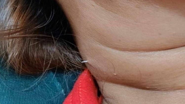 Weird Wide Web – Thaise vrou se aandete steek deur haar nek Weird Wide Web – Thaise vrou se aandete steek deur haar nek | News Article