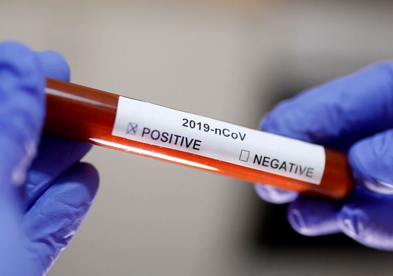 245 new #Covid19 cases recorded in SA | News Article