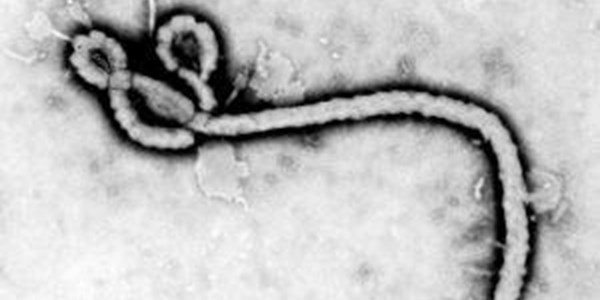 First Ebola case diagnosed in the US | News Article