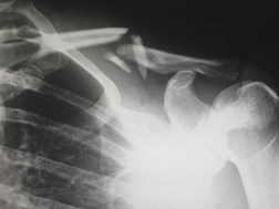 Weird Wide Web – Is hoë SPF sleg vir jou bene? | News Article
