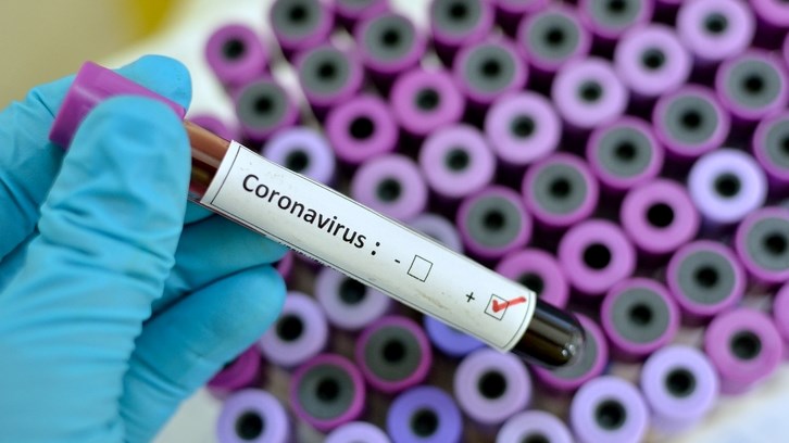 South Africa seeing fifth #Covid19 wave, says health expert South Africa seeing fifth #Covid19 wave, says health expert | News Article
