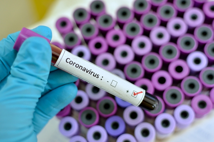 SA records over 20 thousand new #Covid19 cases | News Article