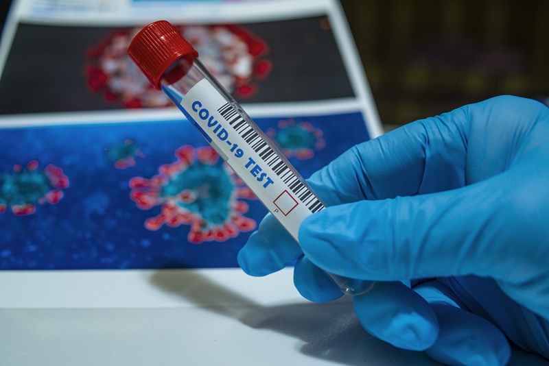 Decrease in #Covid19 deaths, cases reported  | News Article