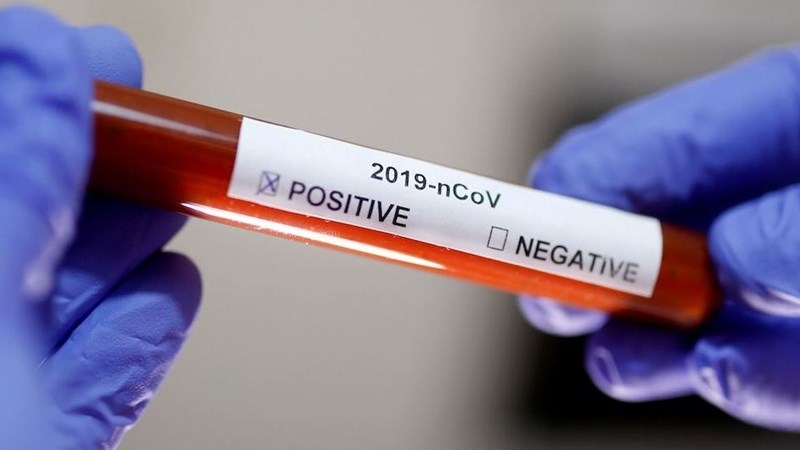 Free State's active #Covid19 cases now second highest in SA Free State's active #Covid19 cases now second highest in SA | News Article