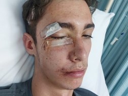 Jong man van Drie Riviere se toekoms onseker ná ongeluk | News Article