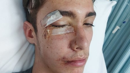Jong man van Drie Riviere se toekoms onseker ná ongeluk Jong man van Drie Riviere se toekoms onseker ná ongeluk | News Article