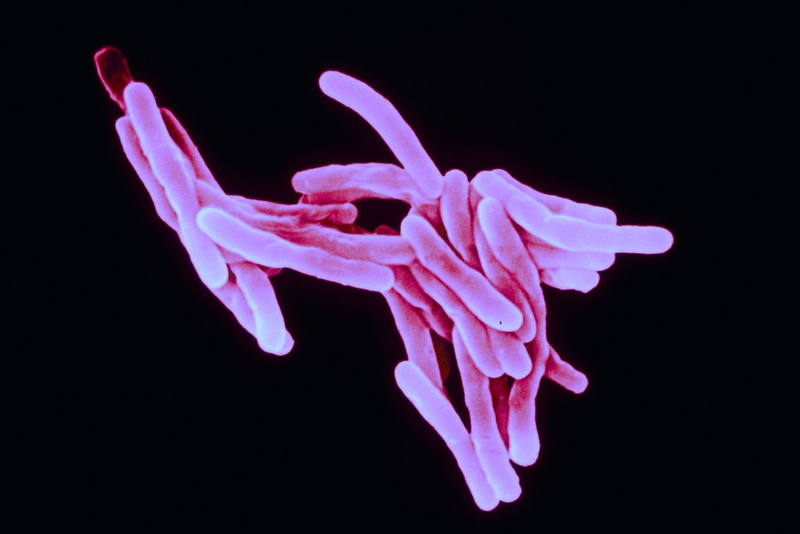 FS premier calls for more effort in fighting TB | News Article