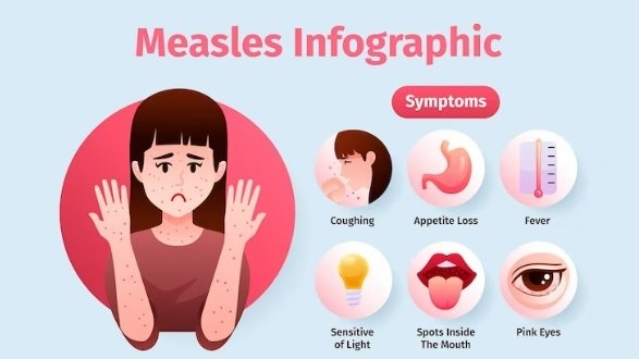 Measles Awareness Campaign started in Free State | News Article