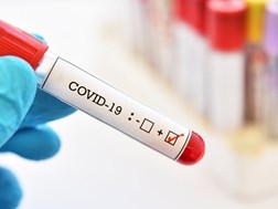 #CoronavirusSA: 2 093 new cases reported  | News Article