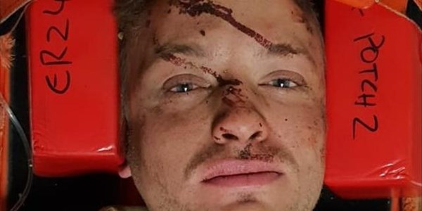 Jong man breek nek in ongeluk Jong man breek nek in ongeluk | News Article