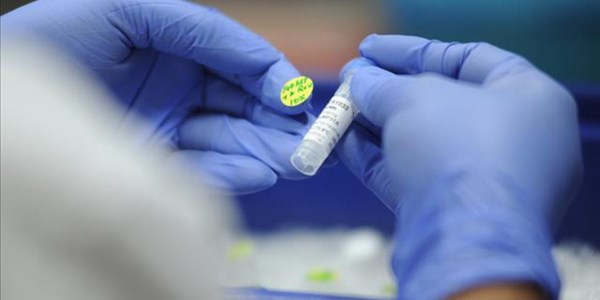 Measles kills approximately 5,000 people in DRC outbreak Measles kills approximately 5,000 people in DRC outbreak | News Article
