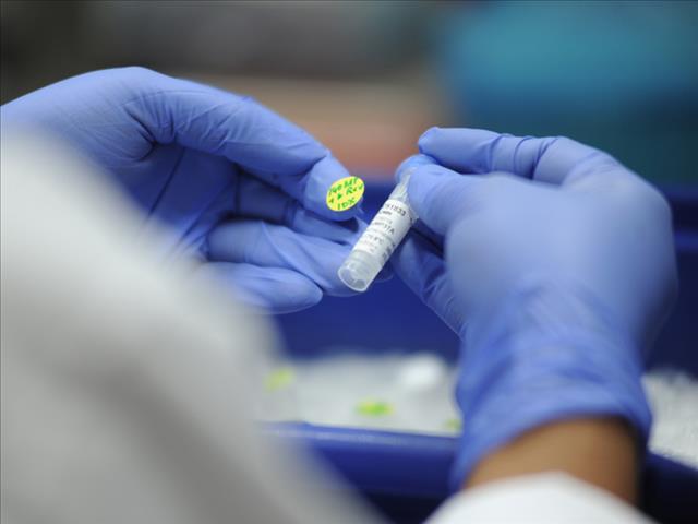 American lab identifies rare new HIV strain | News Article