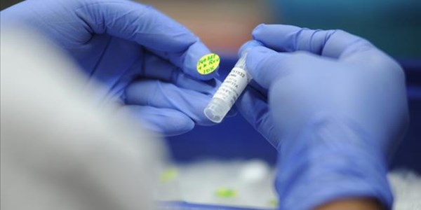 American lab identifies rare new HIV strain | News Article