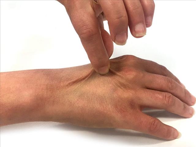 Try This Simple Dehydration Test! | News Article