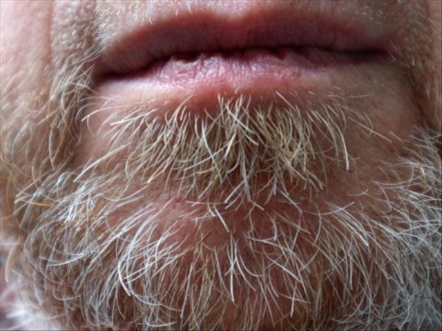 Bearded men carry more germs than dogs – study | News Article