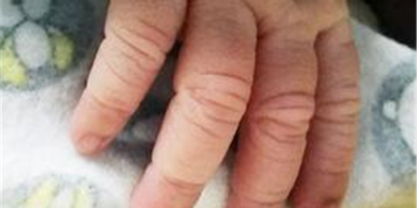 Foetus spine surgery becomes Africa's first Foetus spine surgery becomes Africa's first | News Article