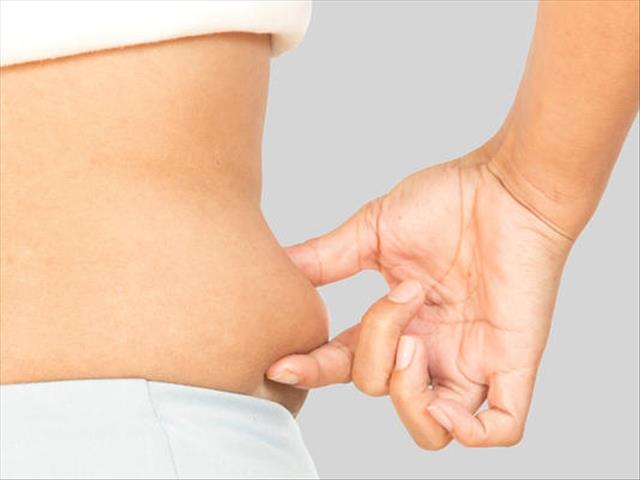 #MedicalMonday - Understanding Liposuction | News Article