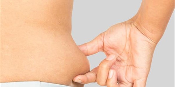 #MedicalMonday - Understanding Liposuction | News Article