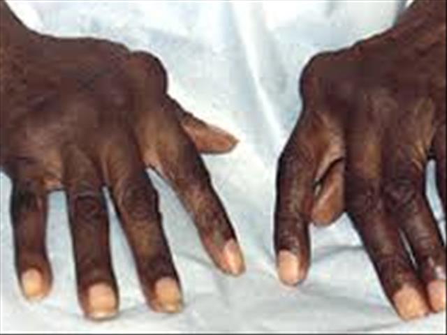 Patient treatment in spotlight in Potchefstroom  | News Article