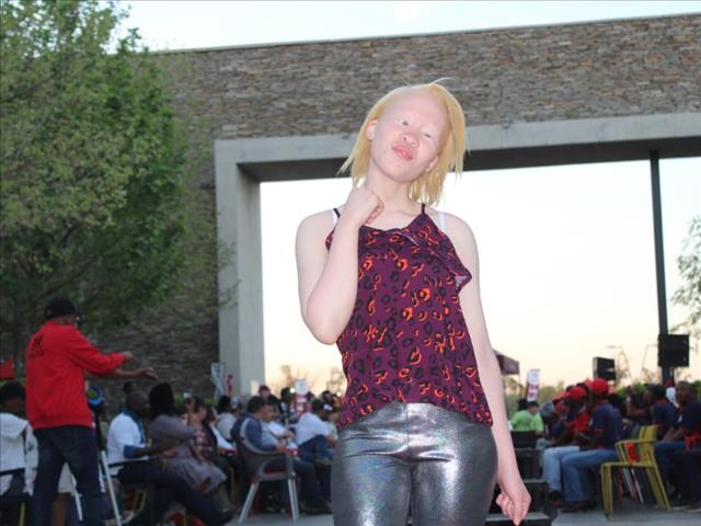Disability and albinism fashion show held in Klerksdorp | News Article