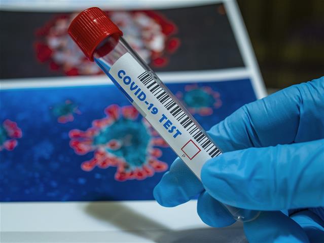 NW records nine more #Covid19 deaths  | News Article