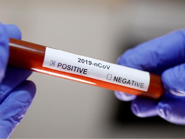 53 more #Covid19 deaths reported in SA | News Article