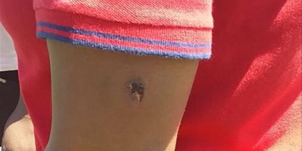 Vaal protesters injured Vaal protesters injured | News Article