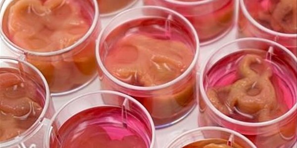 Weird Wide Web - Grow your own steak from your own flesh Weird Wide Web - Grow your own steak from your own flesh | News Article