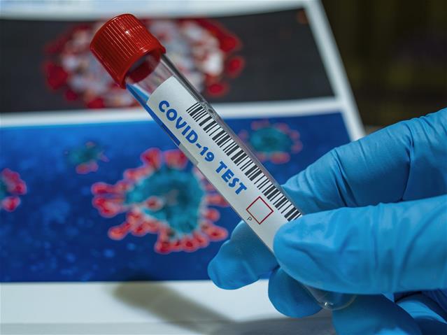 More than 3 000 new #Covid19 cases recorded | News Article