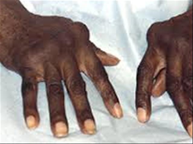 #GBV: NW man accused of grandmother's murder | News Article