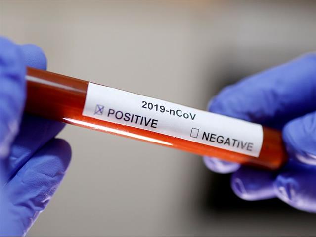 Aspen to make #Covid19 vaccine candidate | News Article