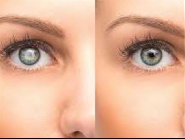 Give the gift of sight this Christmas | News Article