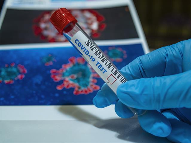 #CoronavirusSA: 72 more deaths recorded | News Article