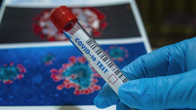 #Covid19 infections increase by 14,305 | News Article