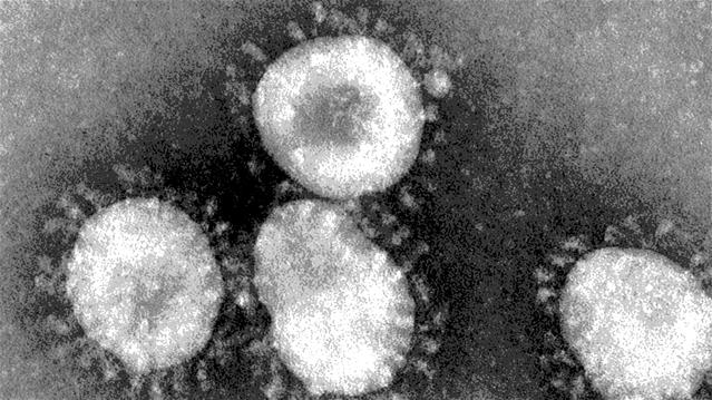 Daily #Coronavirus infections ease slightly | News Article