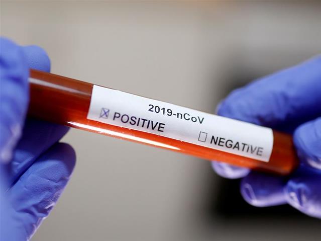 Solidarity Fund commits R327m towards #Covid19 vaccine | News Article
