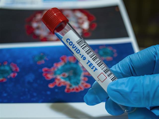 SA records more than 4 900 new #Covid19 cases | News Article