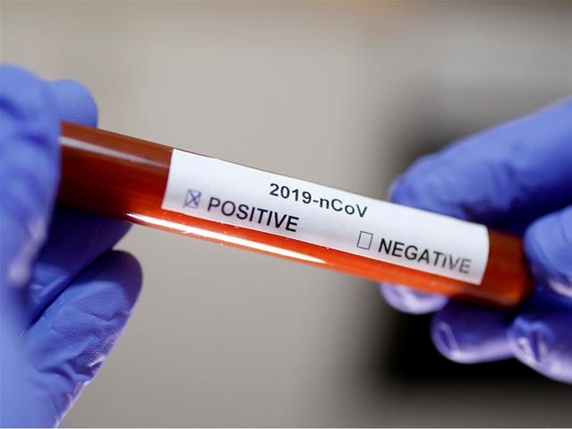 Over 4,000 new #Covid19 cases reported in SA | News Article